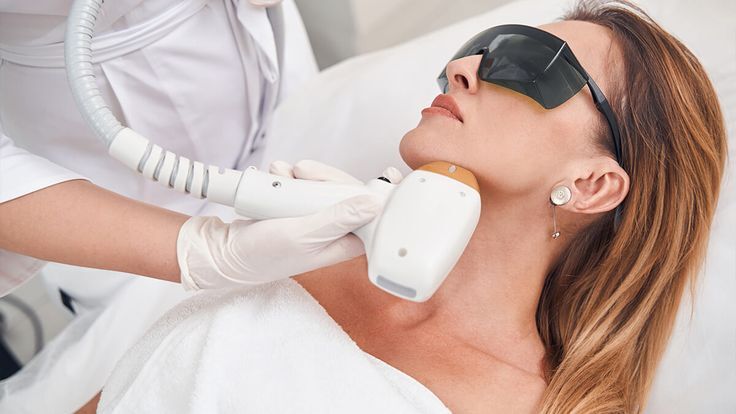 face laser treatment