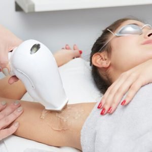 Laser-Hair-Removal