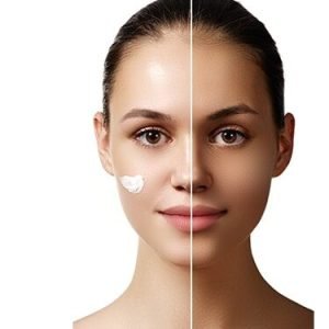 Pigmentation-min